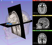 20180426 DataLoadingAndVisualizationTutorial.png