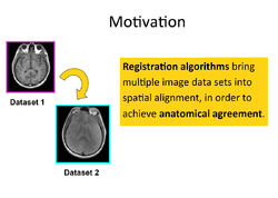 Registration Slicer4.png