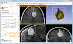 Slicer4 QuantitativeImaging.png