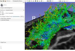 Slicer4DTI Tutorial.png