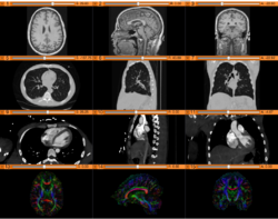 SlicerWelcome tutorial